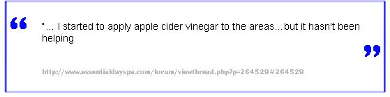 apple cider vinegar psoriasis treatment negative reviews